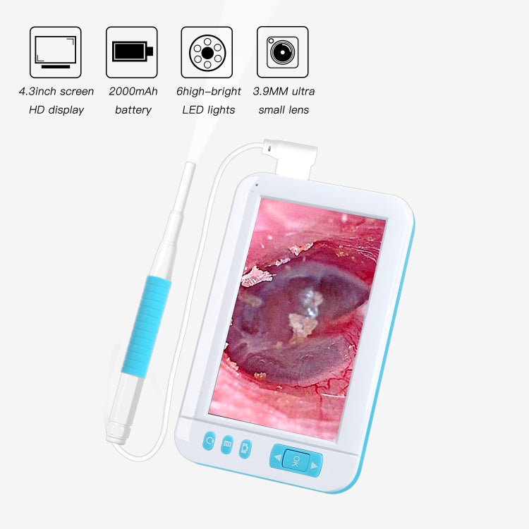 C01 จอแสดงผลขนาด 4.3 นิ้ว HD1080P กล้องส่องกล้อง Earspoon แบบมองเห็นพร้อมไฟ LED 6 ดวงเส้นผ่านศูนย์กลาง: 5.5 มม., C01 5.5mm
