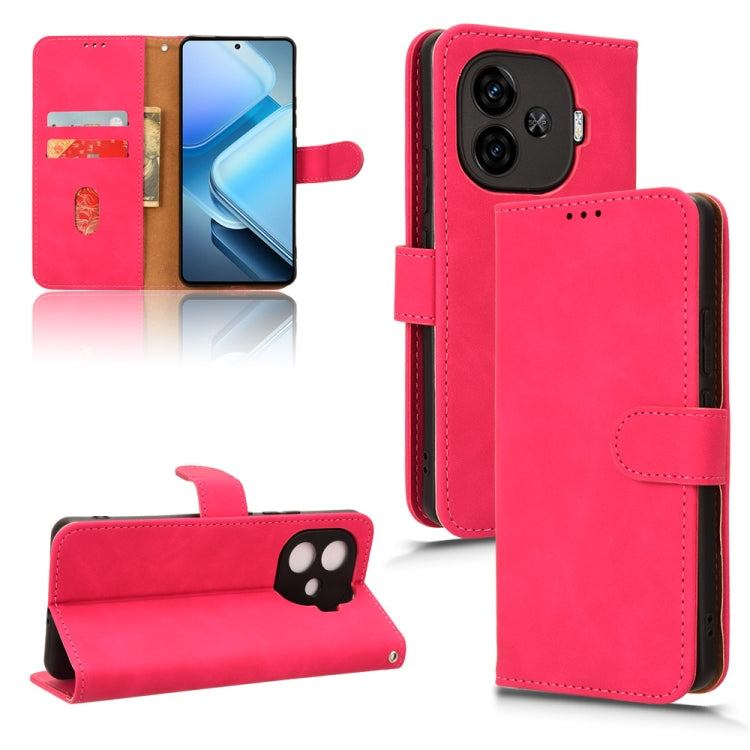 Skin Feel เคสโทรศัพท์หนังแบบแม่เหล็กพลิก, For vivo V30E 5G, For vivo iQOO Z9X, For vivo iQOO Z9, For vivo iQOO Z9 5G Global, For vivo Y03 4G, For vivo S18e, For vivo S18, For vivo X100 Pro, For vivo X100