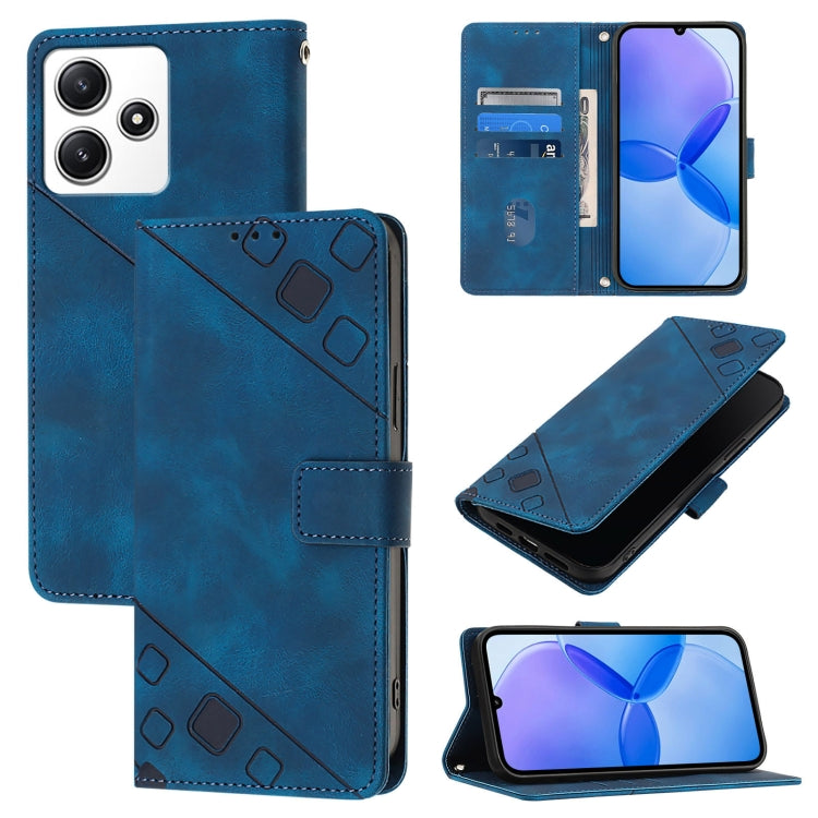 เคสโทรศัพท์หนังลายนูนที่ให้ความรู้สึกเหมือนผิวหนัง, For Xiaomi 14 Ultra, For Xiaomi 14 Pro, For Xiaomi 14, For Xiaomi Redmi Note 13 5G Global, For Xiaomi Redmi 13C, For Xiaomi Redmi Note 13 Pro+ 5G, For Xiaomi Redmi Note 13 Pro 5G Global               ...