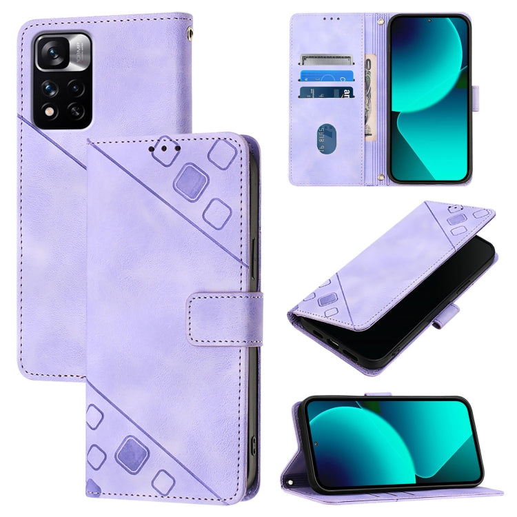 เคสโทรศัพท์หนังลายนูนที่ให้ความรู้สึกเหมือนผิวหนัง, For Xiaomi Civi 3, For Xiaomi Poco M5s / Redmi Note 11 SE India, For Xiaomi Poco X4 NFC 5G, For Xiaomi Redmi Note 11 Pro+ 5G EU, For Xiaomi Civi 1S, For Xiaomi Poco M4 Pro 5G / Redmi Note 11S 5G      ...