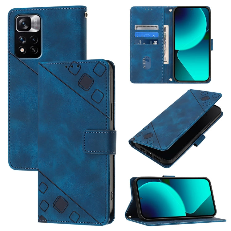 เคสโทรศัพท์หนังลายนูนที่ให้ความรู้สึกเหมือนผิวหนัง, For Xiaomi Civi 3, For Xiaomi Poco M5s / Redmi Note 11 SE India, For Xiaomi Poco X4 NFC 5G, For Xiaomi Redmi Note 11 Pro+ 5G EU, For Xiaomi Civi 1S, For Xiaomi Poco M4 Pro 5G / Redmi Note 11S 5G      ...