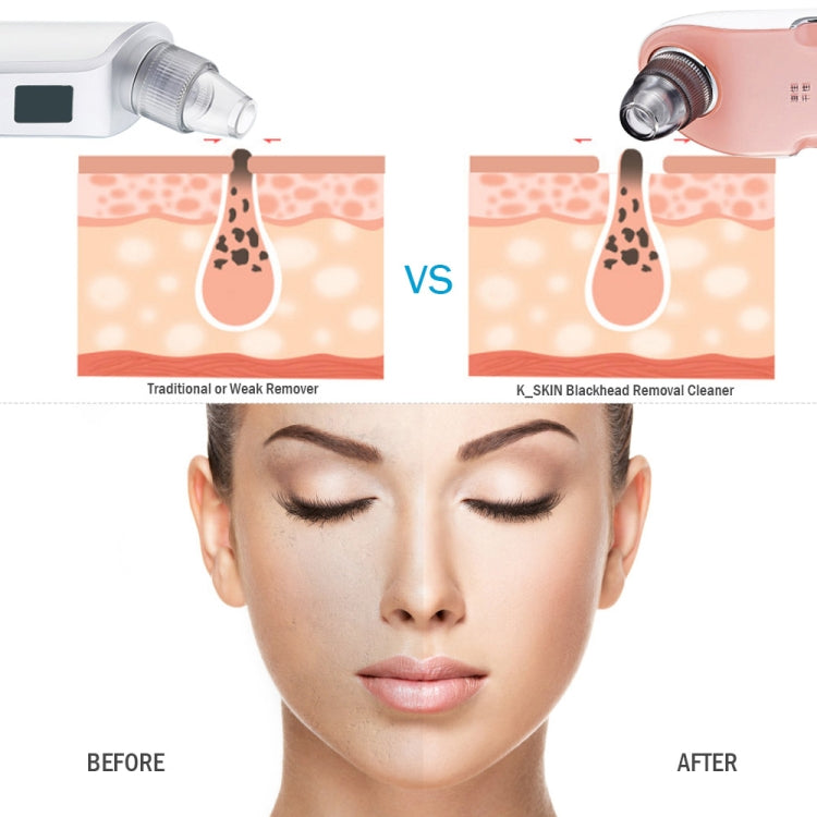 K-SKIN ความเข้ม 3 ระดับ สิวหัวดำ กำจัดรูขุมขน ทำความสะอาดดูด น้ำยาทำความสะอาดจุดดำแบบชาร์จได้ เครื่องทำความสะอาดผิวหน้า, KD803A