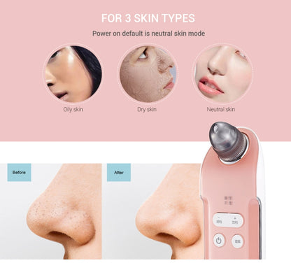 K-SKIN ความเข้ม 3 ระดับ สิวหัวดำ กำจัดรูขุมขน ทำความสะอาดดูด น้ำยาทำความสะอาดจุดดำแบบชาร์จได้ เครื่องทำความสะอาดผิวหน้า, KD803A