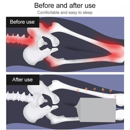 Orthopedic Memory Foam เข่า Wedge หมอนสำหรับ Sleeping อาการปวดตะโพกกลับ Hip Joint Pain Relief Contour ขาต้นขา Pad สนับสนุนเบาะ, White, White+bandage, Navy blue grid+bandage