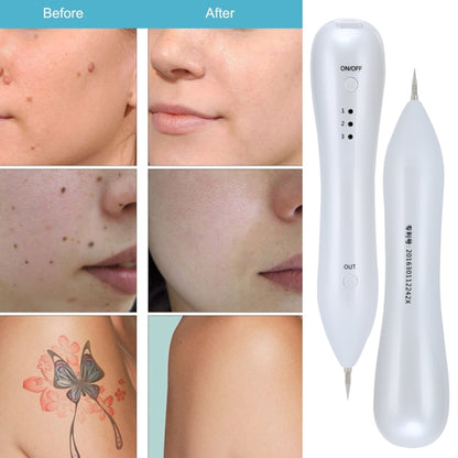 Dark Spot Remover USB เลเซอร์พลาสม่าปากกา Facial Freckle Wart Removal Beauty Care อุปกรณ์