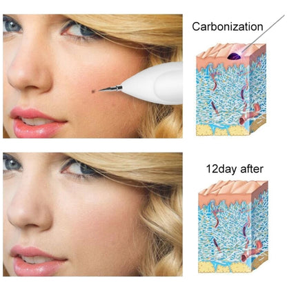 Dark Spot Remover USB เลเซอร์พลาสม่าปากกา Facial Freckle Wart Removal Beauty Care อุปกรณ์