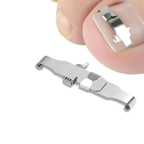 Orthopedic Buckle Toe Nail Groove คุดเล็บ Corrector, No. 36 Positive Nail Buckle, No. 38 Positive Nail Buckle, No. 40 Positive Nail Buckle, No. 42 Positive Nail Buckle, No. 44 Positive Nail Buckle, No. 36 Set, No. 38 Set, No. 40 Set, No. 42 Set        ...