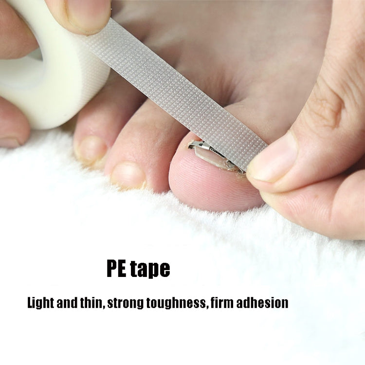 Orthopedic Buckle Toe Nail Groove คุดเล็บ Corrector, No. 36 Positive Nail Buckle, No. 38 Positive Nail Buckle, No. 40 Positive Nail Buckle, No. 42 Positive Nail Buckle, No. 44 Positive Nail Buckle, No. 36 Set, No. 38 Set, No. 40 Set, No. 42 Set        ...