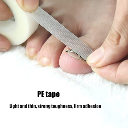Orthopedic Buckle Toe Nail Groove คุดเล็บ Corrector, No. 36 Positive Nail Buckle, No. 38 Positive Nail Buckle, No. 40 Positive Nail Buckle, No. 42 Positive Nail Buckle, No. 44 Positive Nail Buckle, No. 36 Set, No. 38 Set, No. 40 Set, No. 42 Set        ...