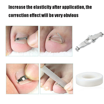 Orthopedic Buckle Toe Nail Groove คุดเล็บ Corrector, No. 36 Positive Nail Buckle, No. 38 Positive Nail Buckle, No. 40 Positive Nail Buckle, No. 42 Positive Nail Buckle, No. 44 Positive Nail Buckle, No. 36 Set, No. 38 Set, No. 40 Set, No. 42 Set        ...