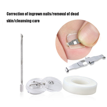 Orthopedic Buckle Toe Nail Groove คุดเล็บ Corrector, No. 36 Positive Nail Buckle, No. 38 Positive Nail Buckle, No. 40 Positive Nail Buckle, No. 42 Positive Nail Buckle, No. 44 Positive Nail Buckle, No. 36 Set, No. 38 Set, No. 40 Set, No. 42 Set        ...