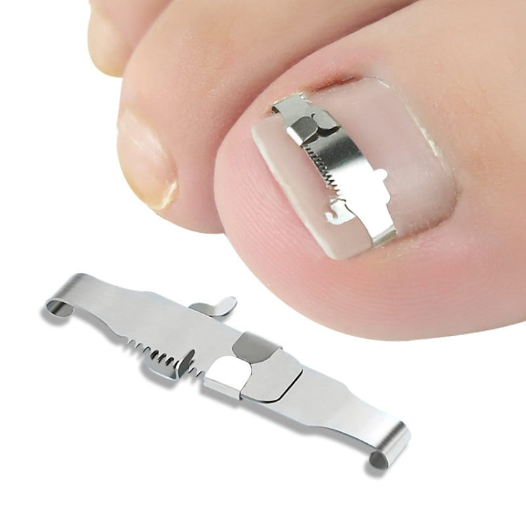 Orthopedic Buckle Toe Nail Groove คุดเล็บ Corrector, No. 36 Positive Nail Buckle, No. 38 Positive Nail Buckle, No. 40 Positive Nail Buckle, No. 42 Positive Nail Buckle, No. 44 Positive Nail Buckle, No. 36 Set, No. 38 Set, No. 40 Set, No. 42 Set        ...