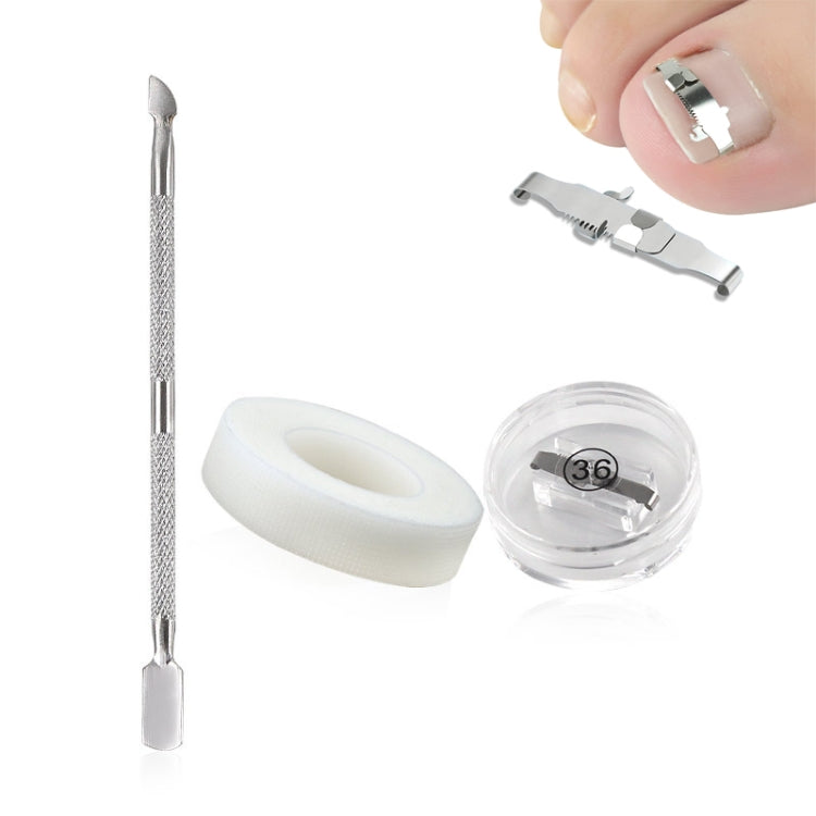 Orthopedic Buckle Toe Nail Groove คุดเล็บ Corrector, No. 36 Positive Nail Buckle, No. 38 Positive Nail Buckle, No. 40 Positive Nail Buckle, No. 42 Positive Nail Buckle, No. 44 Positive Nail Buckle, No. 36 Set, No. 38 Set, No. 40 Set, No. 42 Set        ...