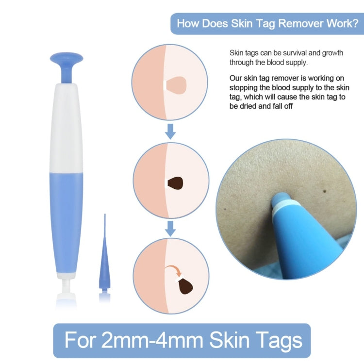 เครื่องมือกำจัดแท็กผิวหนังสำหรับแท็กผิวหนังขนาด 2 มม. - 4 มม, Skin Tag Removal Tool