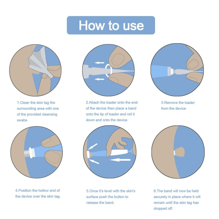 เครื่องมือกำจัดแท็กผิวหนังสำหรับแท็กผิวหนังขนาด 2 มม. - 4 มม, Skin Tag Removal Tool