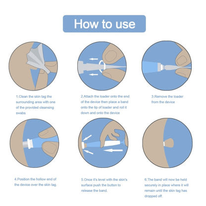 เครื่องมือกำจัดแท็กผิวหนังสำหรับแท็กผิวหนังขนาด 2 มม. - 4 มม, Skin Tag Removal Tool