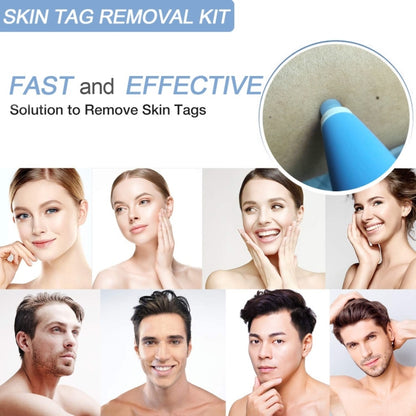 เครื่องมือกำจัดแท็กผิวหนังสำหรับแท็กผิวหนังขนาด 2 มม. - 4 มม, Skin Tag Removal Tool