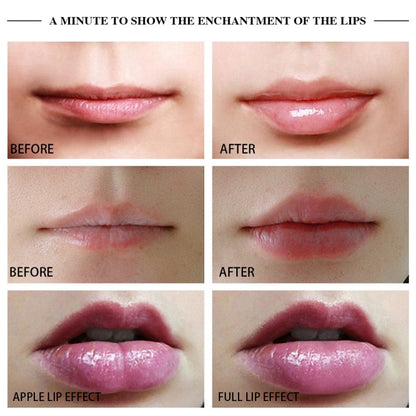 ซิลิโคน Lip Plumper อุปกรณ์ไฟฟ้า Lip Plump Enhancer เครื่องมือดูแล