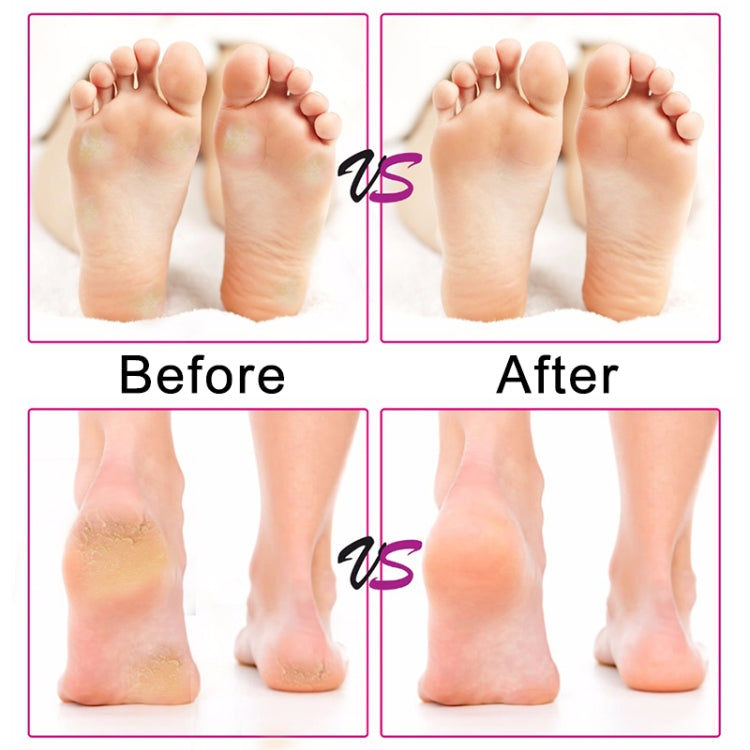 เท้าไฟฟ้าความเร็วปรับกระดาษทรายแผ่นแคลลัส Remover Pedicure Fast ลบฟุต Hard Cracked แห้ง Dead Skin เครื่องมือ, US plug, EU plug, UK plug
